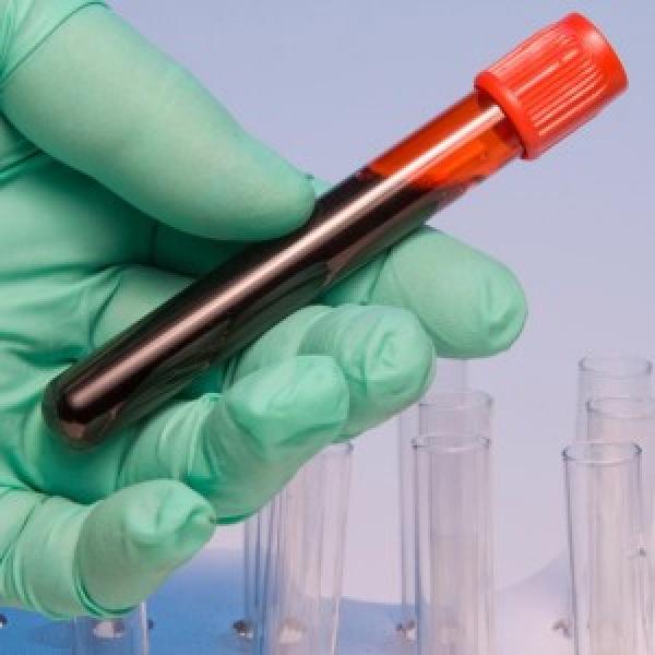 Smart Oxygen Cuvette for Optical Monitoring of Dissolved Oxygen in Biological Blood Samples